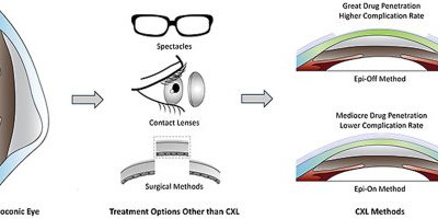 myoring implant